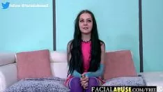 تشغيل البلعوم الجزئي الفرعي الضئيل خشن